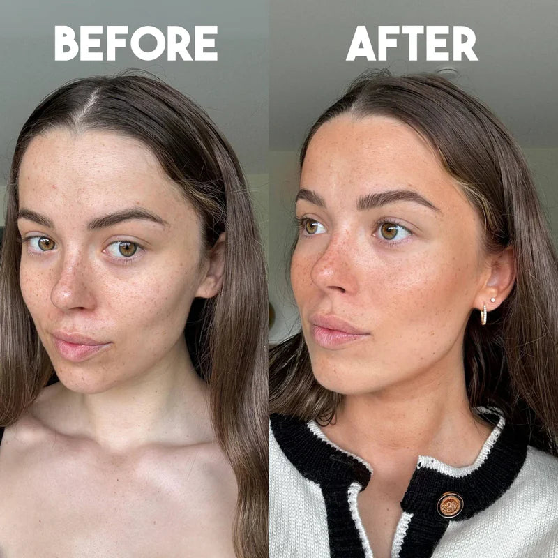 Sunkiss Bio patch routine