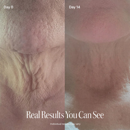 SILVLIFELABS NECK FIRMING CREAM
